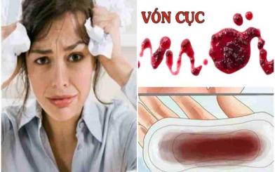 Máu kinh vón cục màu đen là bị làm sao? Cách khắc phục hiệu quả