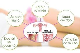 Giải đáp làm sao để biết bị mắc bệnh phụ khoa, bệnh phụ khoa có nguy hiểm không