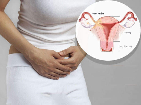 Các bệnh viêm nhiễm phụ khoa nguy hiểm thường gặp và cách chữa