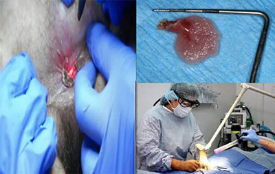 Sùi mào gà có ngứa không? Cách nhận biết và chữa trị