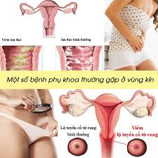 Giải đáp làm sao để biết bị mắc bệnh phụ khoa, bệnh phụ khoa có nguy hiểm không