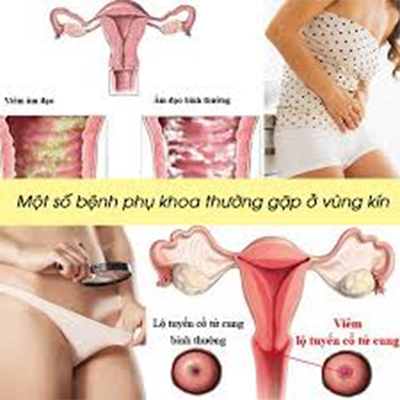 Triệu chứng bệnh phụ khoa phổ biến cần biết để kịp thời đi khám và điều trị