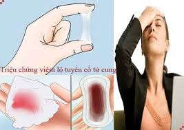 Nguyên nhân hàng đầu gây bệnh phụ khoa chị em phụ nữ ai cũng nên biết